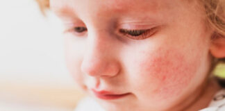 AZS a jakość powietrza